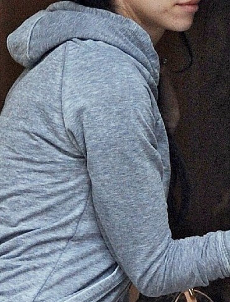 Δείτε μία από τις ωραιότερες γυναίκες του πλανήτη άβαφτη με σπυριά και μαύρους κύκλους