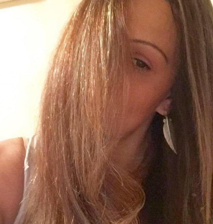 Κύπρια ηθοποιός καταγγέλει μέσα από τα social media άντρα ότι την κτύπησε