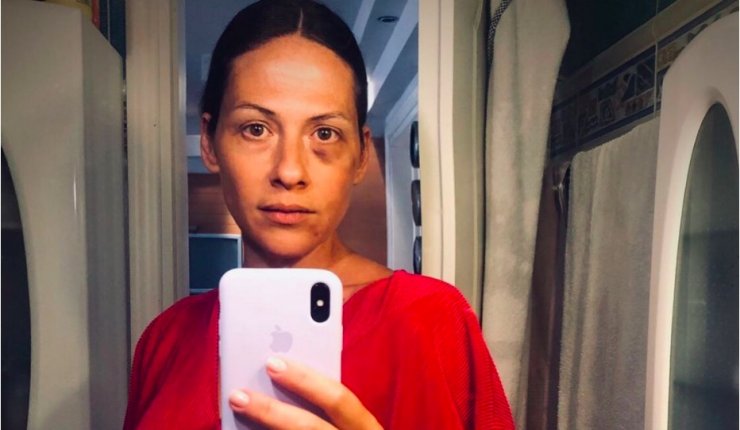 Μαρία Δεληθανάση: Το συγκλονιστικό ποστ της πρώην συζύγου του Κώστα Δόξα που τον κατήγγειλε για ξυλοδαρμό