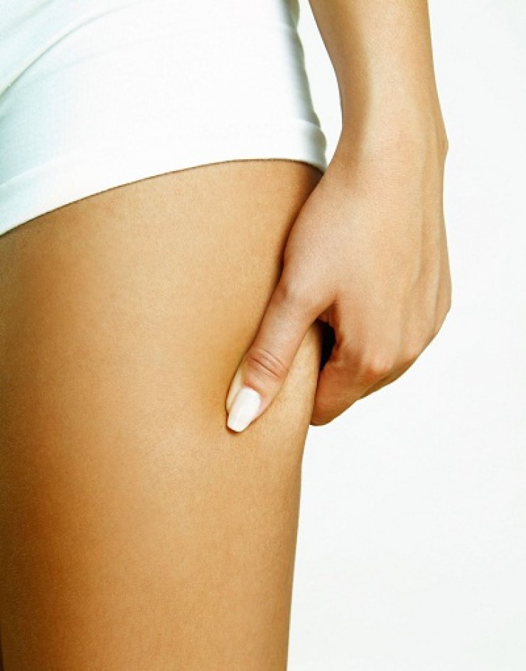 5 tips για να "γλυτώσεις" από την κυτταρίτιδα