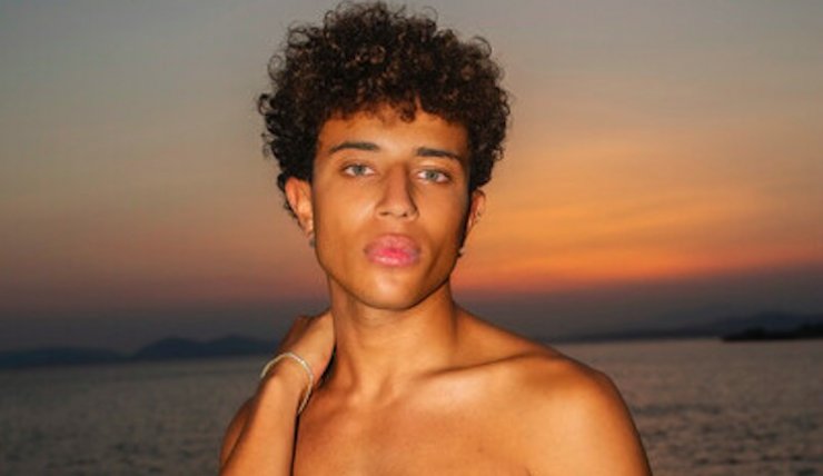 Ηρακλής Τσουζίνοφ: Ατύχημα στη θάλασσα για τον νικητή του GNTM! Η εικόνα με το χτυπημένο πρόσωπο του