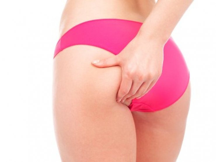 Χρήσιμες συμβουλές για να πεις αντίο στην κυτταρίτιδα μια για πάντα  