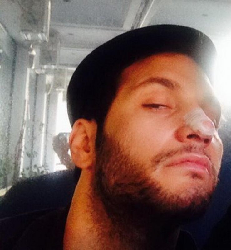 Ευθύμης Ζησάκης: Εσπευσμένα στο χειρουργείο! 