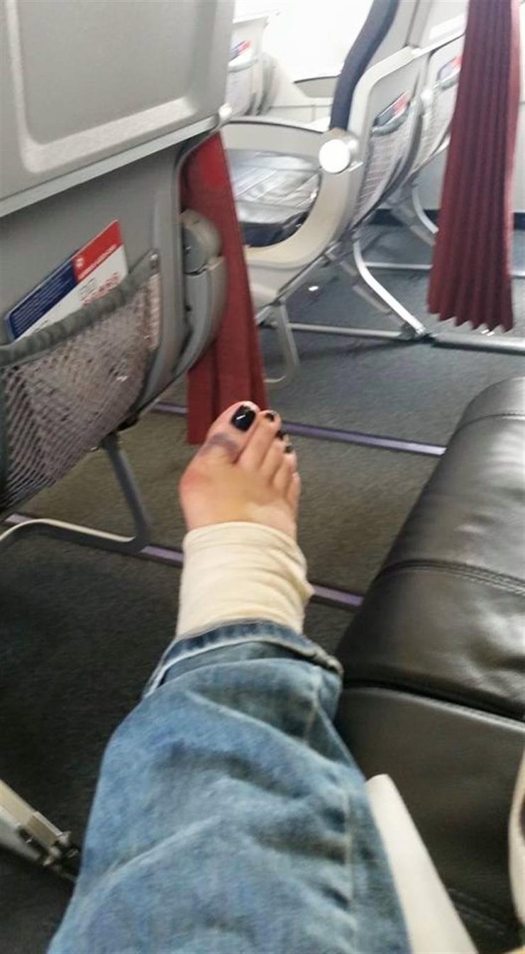 Το ατύχημα ηθοποιού σε κυπριακή σειρά 