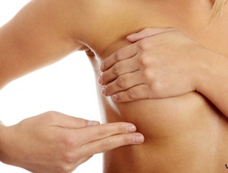  Καρκίνος του μαστού: Καταρρίπτουμε 6 μύθους γύρω από αυτόν