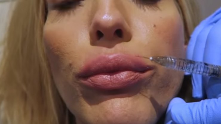 Ελληνίδα παρουσιάστρια φούσκωσε τα χείλη της και μας το έδειξε! [βίντεο]