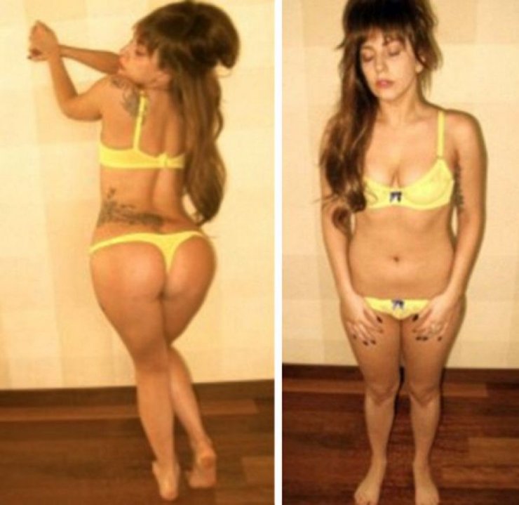 Η Gaga στη μάχη κατά της ανορεξίας!