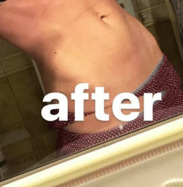 Πάθαμε πλάκα! Αυτό είναι το σώμα επώνυμης Ελληνίδας πέντε μήνες μετά τη γέννηση του μωρού της!