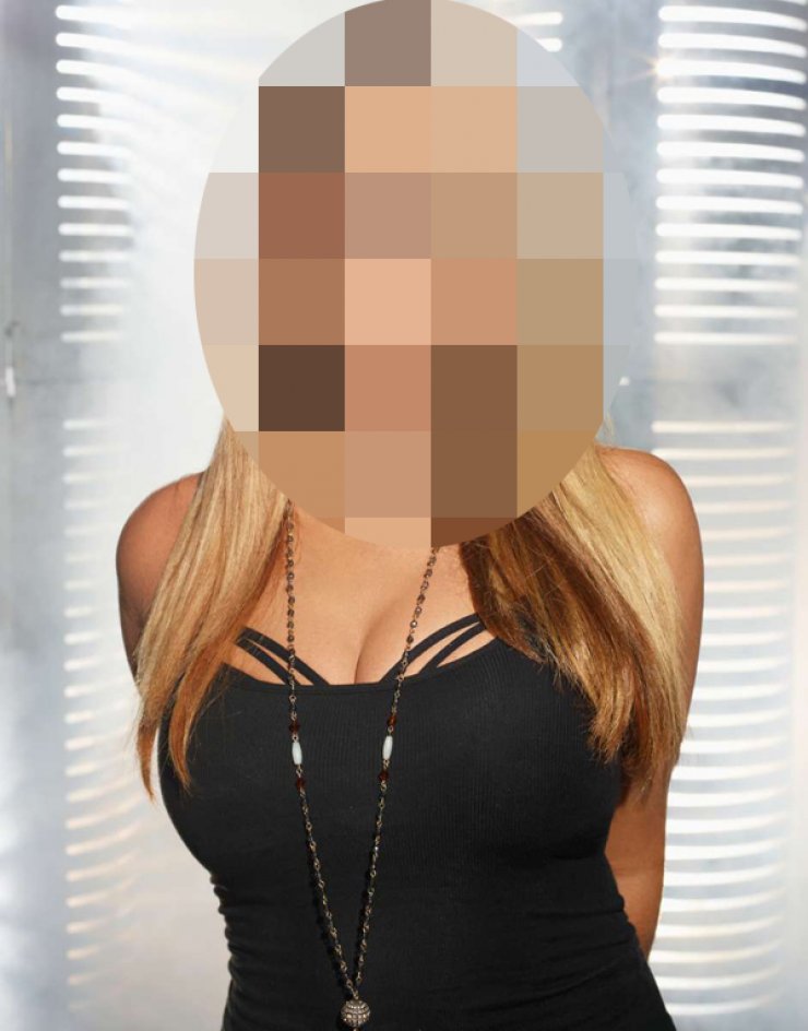 Πασίγνωστη τραγουδίστρια εξομολογείται: "Είχα τρέλα με το botox"