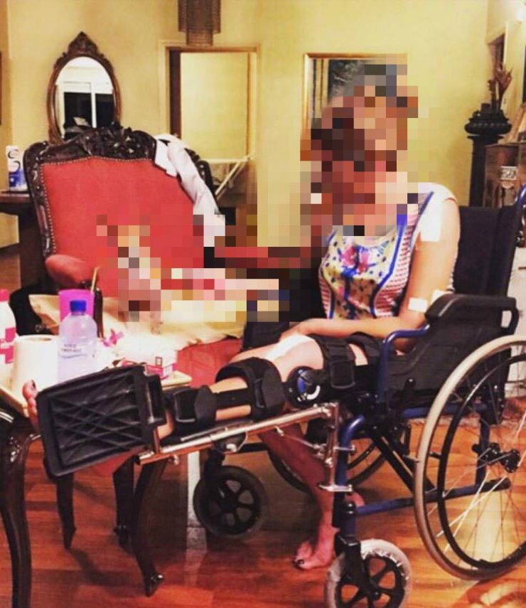 Το σοβαρό ατύχημα Κύπριας socialite που την αναγκάζει για δύο μήνες να βρίσκεται σε τροχοκάθισμα