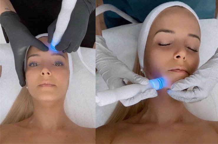 Nέο AQUA DERM+ : Η περιποίηση προσώπου που σου χαρίζει το Hollywood GLOW