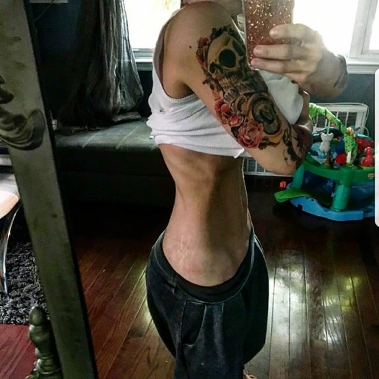 Σοκάρει η σκελετωμένη εικόνα επώνυμης Ελληνίδας