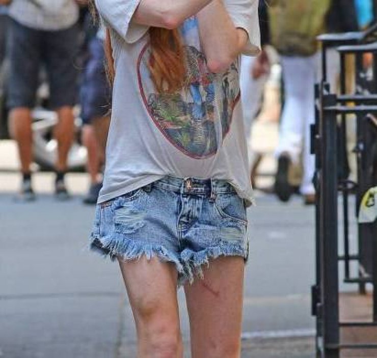  Φανερά αδυνατισμένη και με μελανιές στα πόδια πασίγνωστη ηθοποιός!