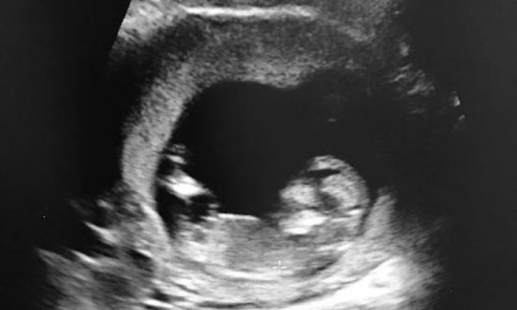 Γνωστό ζευγάρι ανακοίνωσε τον ερχομό του πρώτου του παιδιού την Ημέρα της Μητέρας