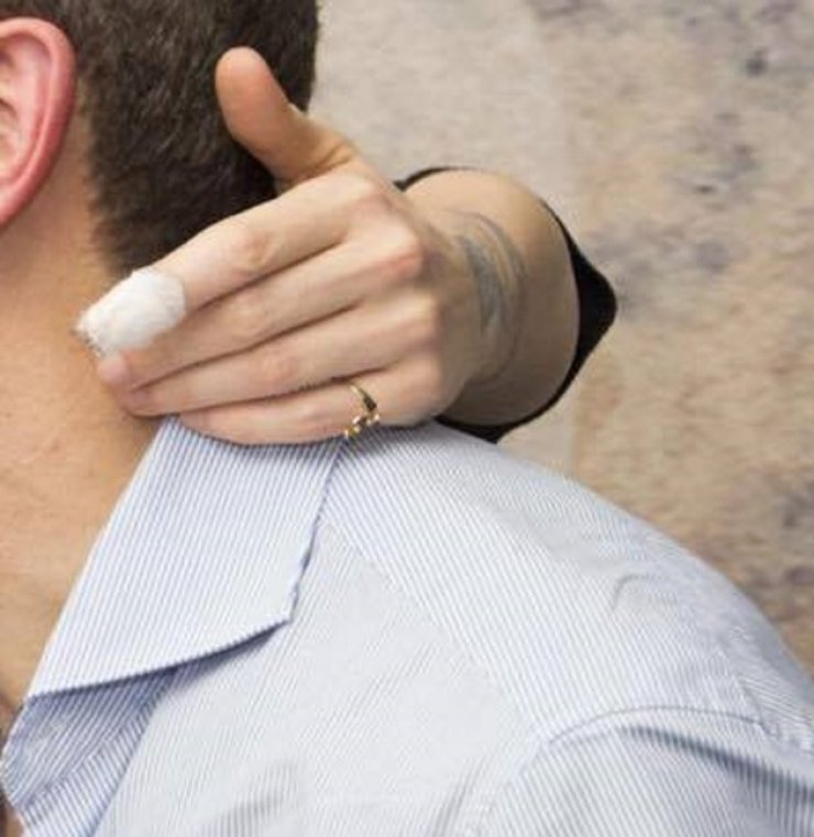 Απίστευτο: Το σοβαρό ατύχημα Ελληνίδας ηθοποιού. Έχασε μέρος του δαχτύλου της