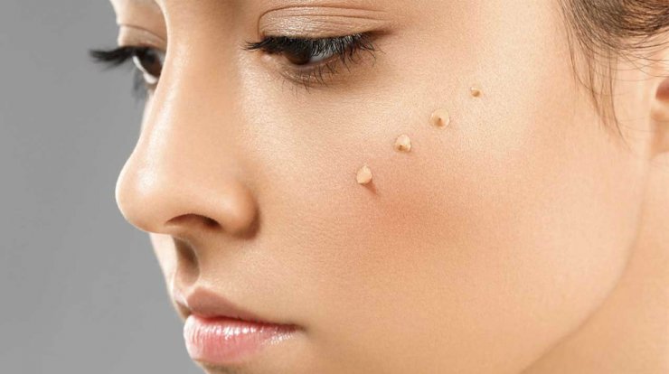 Φτιάξε μόνη σου την τέλεια BB Cream