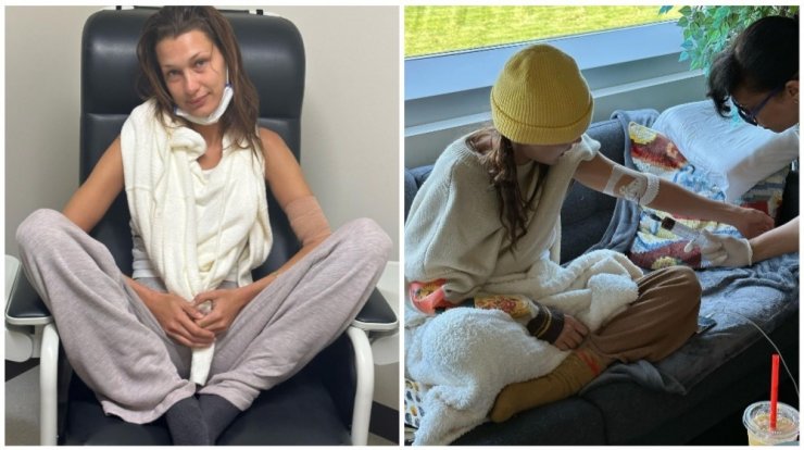 Bella Hadid: Η μάχη με τη νόσο Lyme – Οι εικόνες που δημοσίευσε κατά τη διάρκεια της θεραπείας 