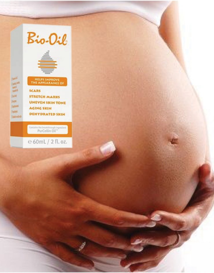 Bio-Oil: Σύμμαχος για όμορφη επιδερμίδα, κατά τη διάρκεια της εγκυμοσύνης και του θηλασμού!