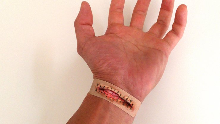 Τσιρότα Boo boos