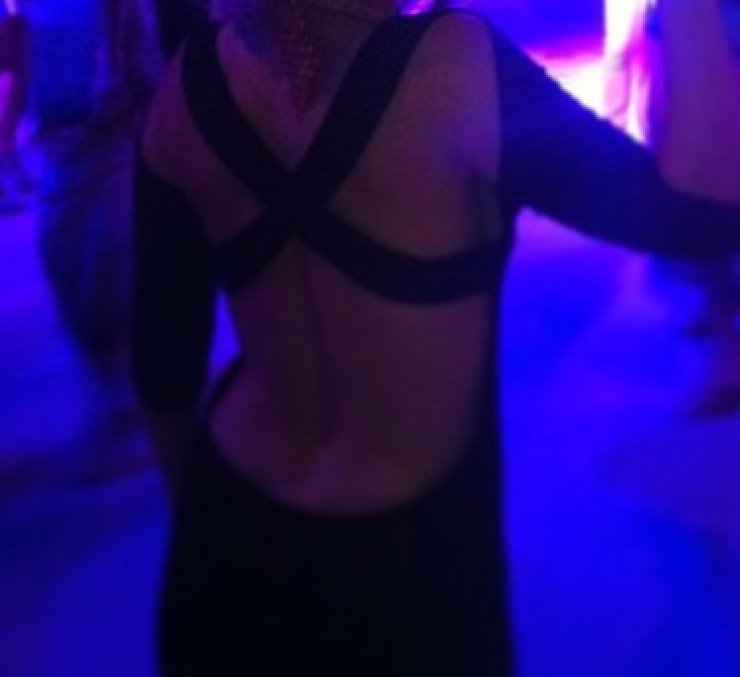 Ποια Ελληνίδα διαθέτει αυτή τη sexy πλάτη;