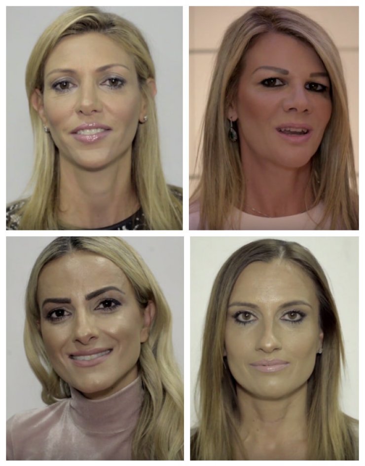 Το μήνυμα που στέλνουν 12 Κύπριες για τον καρκίνο του μαστού!