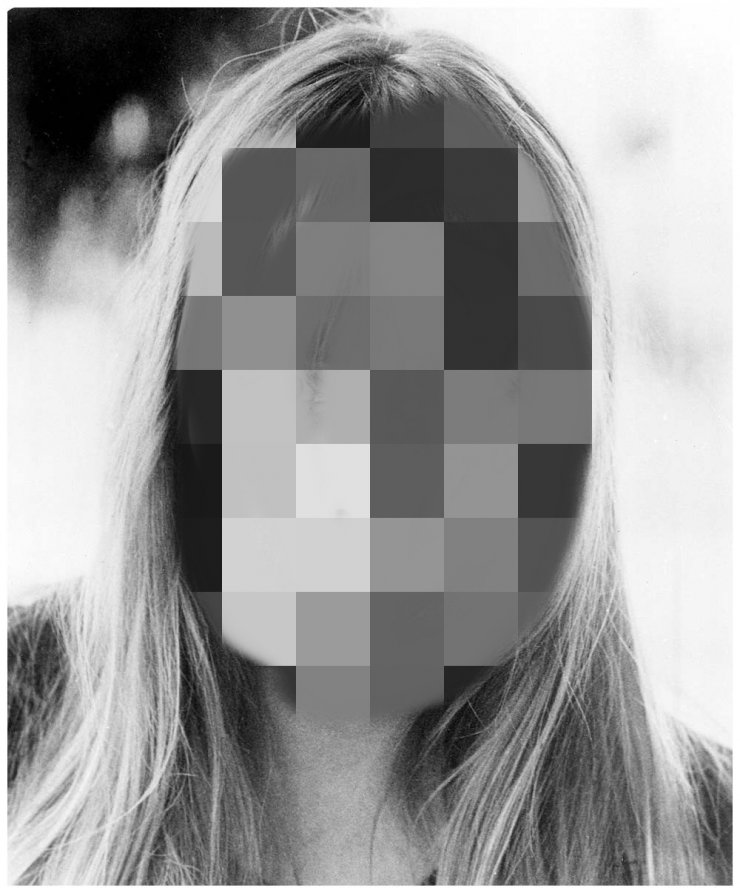 Διάσημη τραγουδίστρια νοσηλεύεται στην εντατική