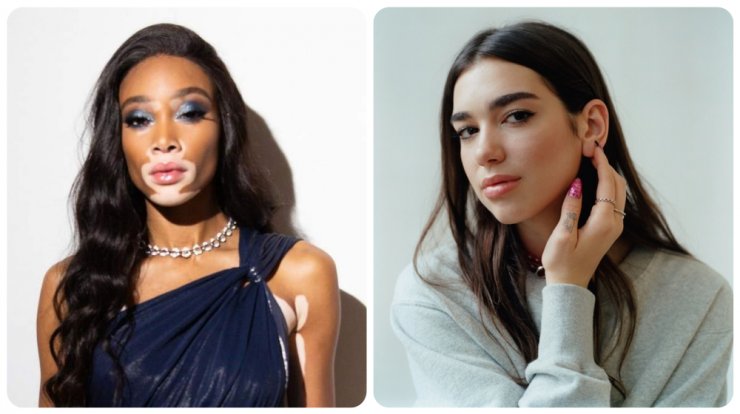 Κύπρια socialite ποζάρει με την Winnie Harlow και τη Dua Lipa! [εικόνες]