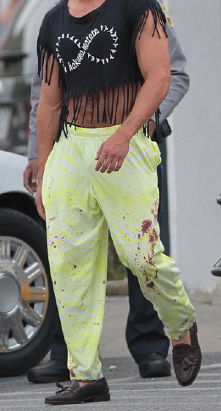 Πασίγνωστος ηθοποιός κυκλοφορεί στους δρόμους με ματωμένα ρούχα [εικόνες]