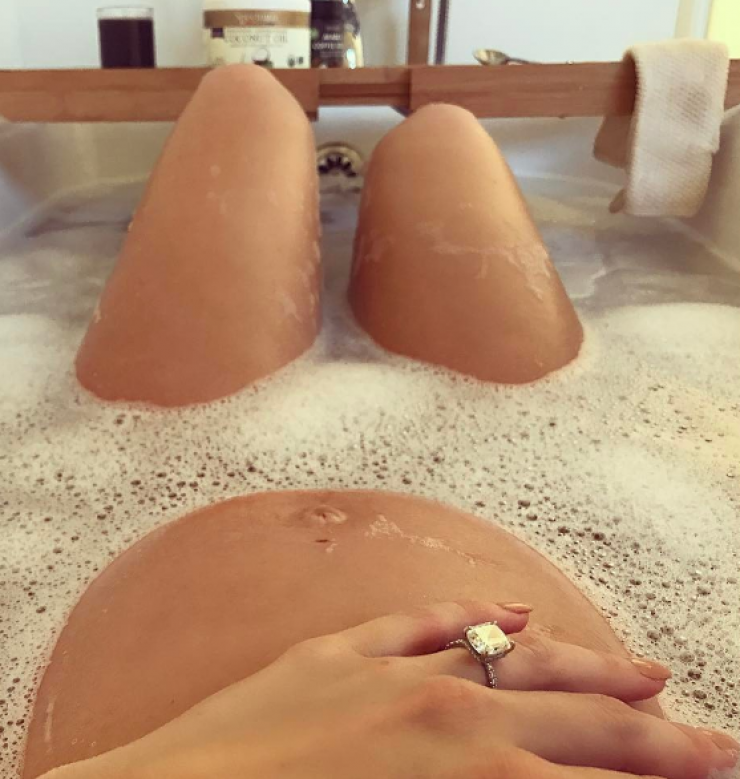 Με αυτή τη φωτογραφία πασίγνωστο μοντέλο επιβεβαιώνει εγκυμοσύνη και αρραβώνα!