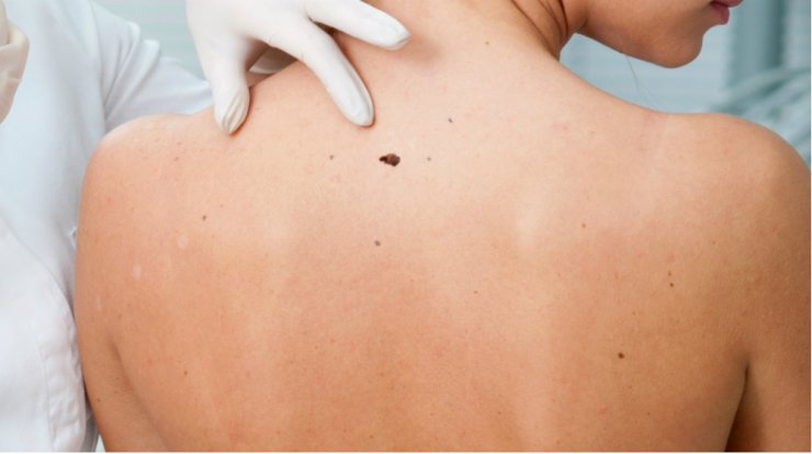 Μετά το καλοκαίρι κοιτάζω τις ελιές μου