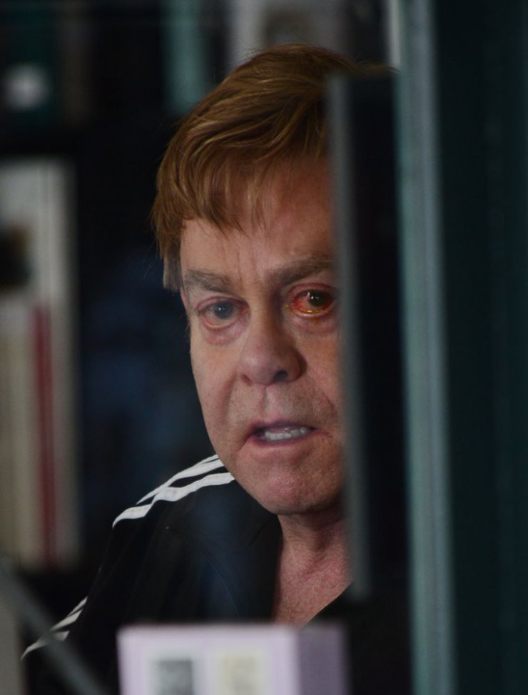 Elton John: Ταλαιπωρία με μόλυνση στο μάτι [εικόνες]