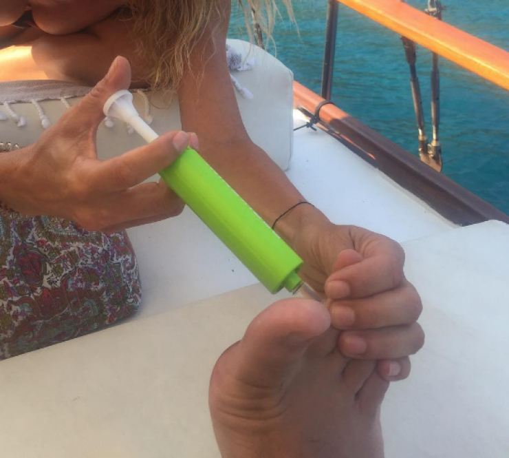 Ο τραυματισμός Έλληνα παρουσιαστή στις διακοπές του!