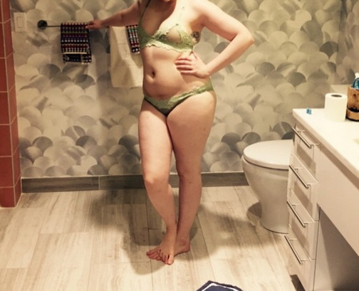 Η πασίγνωστη ηθοποιός που τολμά να φωτογραφηθεί παρά τις ατέλειές της!