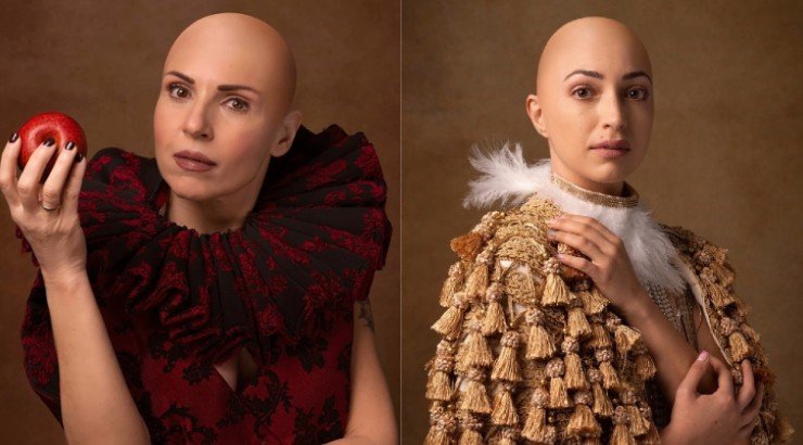 Κρίστυ Παπαδοπούλου και Ευρυδίκη: Φωτογραφήθηκαν χωρίς μαλλιά και στέλνουν ηχηρό μήνυμα στήριξης