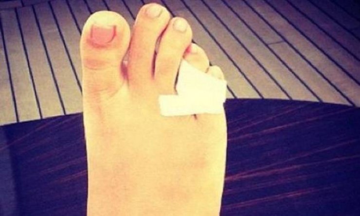 Ποιά διάσημη έσπασε το δάχτυλό της;