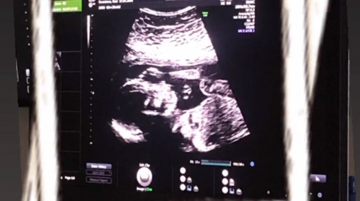 Κύπρια ηθοποιός μας αποκάλυψε την εγκυμοσύνη της δείχνοντάς μας το υπερηχογράφημα [εικόνα]