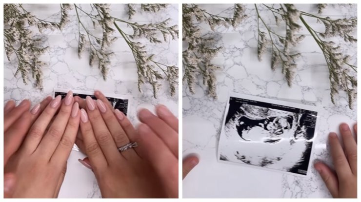 Ζευγάρι της κυπριακής showbiz περιμένει το δεύτερο μωράκι του [βίντεο]