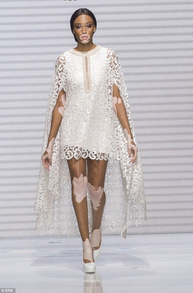 Διαφορετική ομορφιά: Η Winnie Harlow έκλεψε τις εντυπώσεις στην εβδομάδα μόδας στο Παρίσι