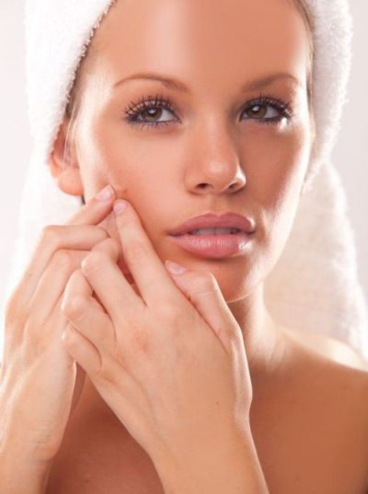 3 φυσικοί τρόποι για να εξαφανίσεις το σπυράκι σε χρόνο dt