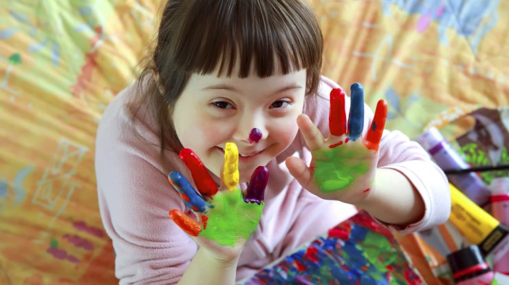 Ανακαλύπτοντας τα παιδιά με Σύνδρομο Down: Όλα όσα πρέπει να γνωρίζετε!