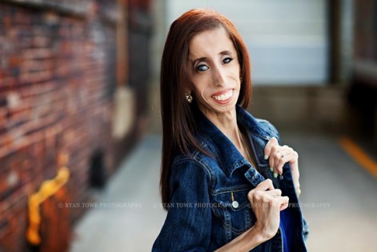 Η ασχημότερη γυναίκα στον κόσμο ενάντια στο bullying 