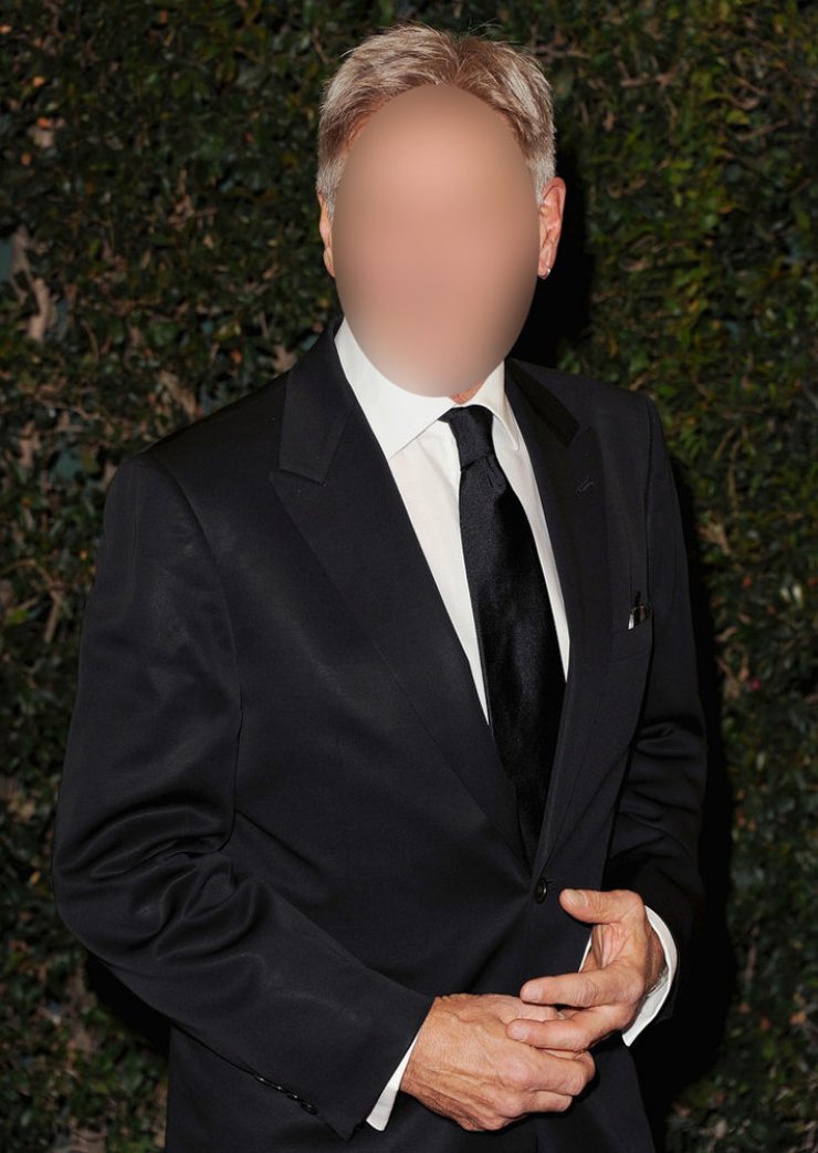 Ποιος ηθοποιός τραυματίστηκε σοβαρά;