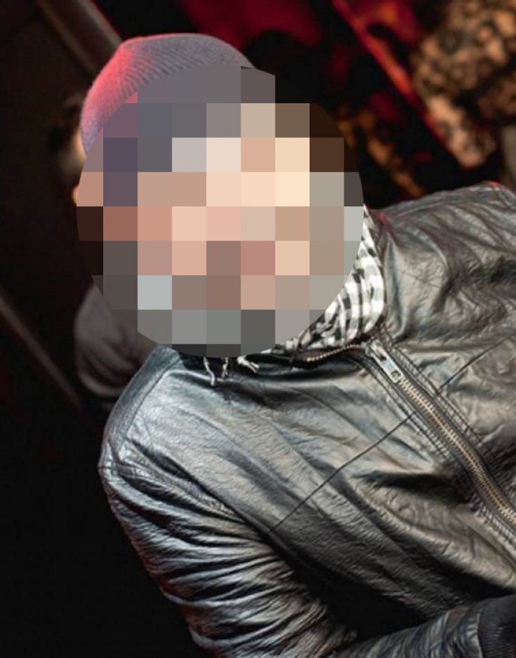 Τράκαρε Έλληνας ηθοποιός και το μισό μου πρόσωπο έγινε πολτός!