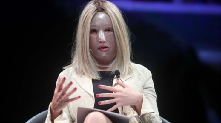 Ιωάννα Παλιοσπύρου: Δείτε την να γυμνάζεται για πρώτη φορά μετά την επίθεση με βιτριόλι [βίντεο]