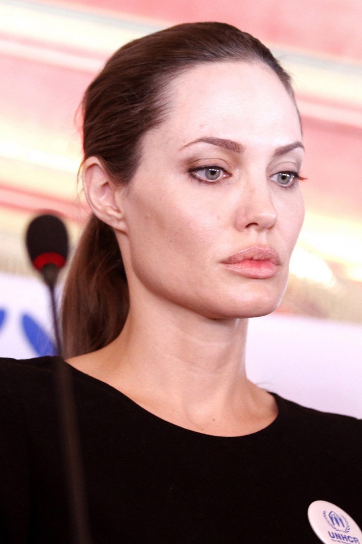 Σοκάρουν οι δηλώσεις της χειρουργού της Angelina Jolie