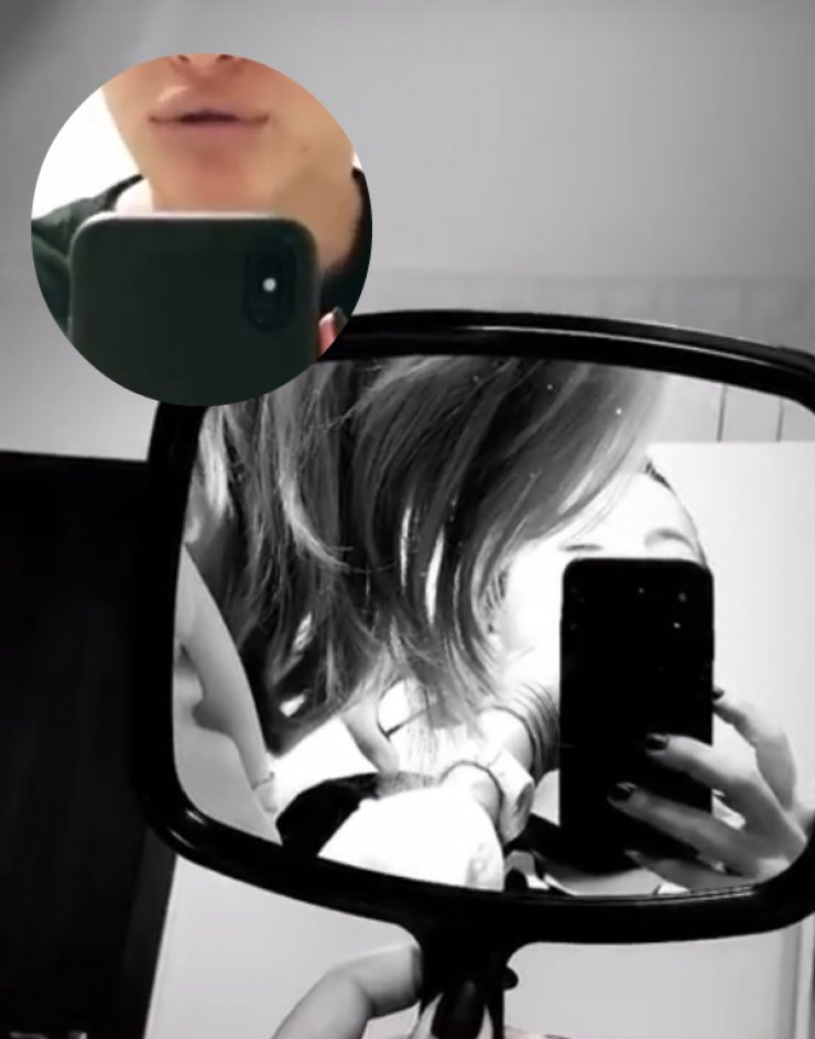 Επώνυμη Κύπρια φούσκωσε τα χείλη της και μας έδειξε τη διαδικασία στο instagram!