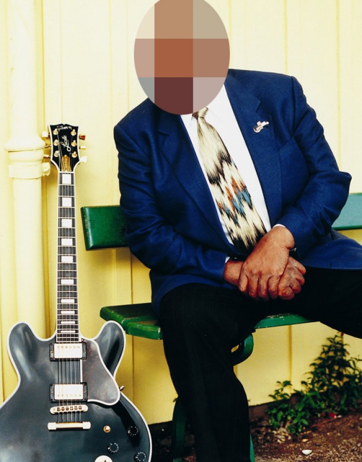 Εσπευσμένα στο νοσοκομείο πασίγνωστος καλλιτέχνης!