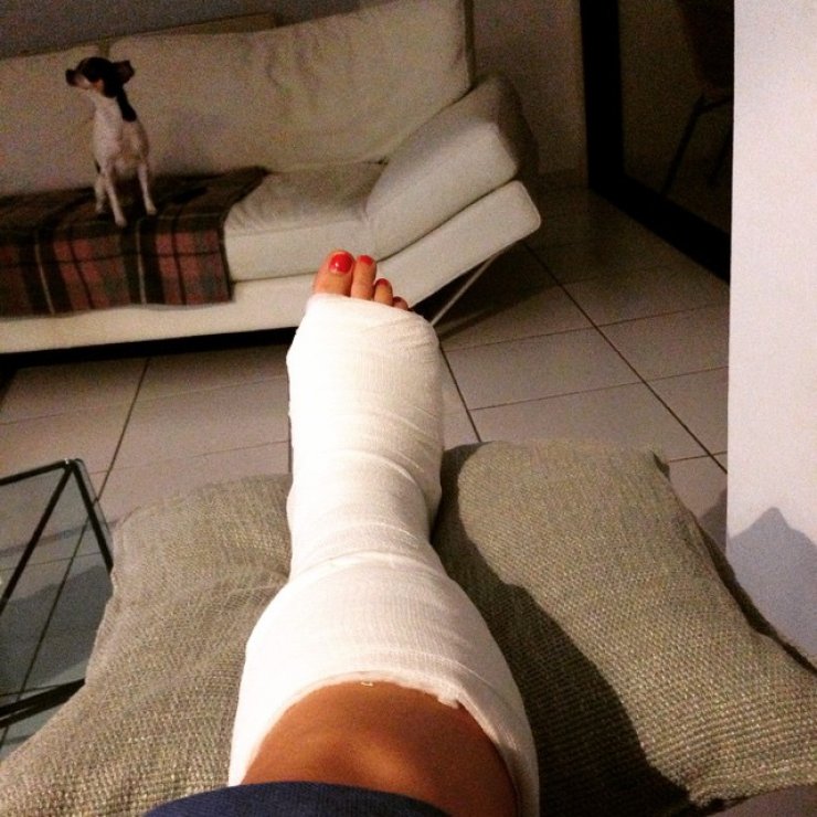 To κλάμα Κύπριας ηθοποιού για το κάταγμα του ποδιού της