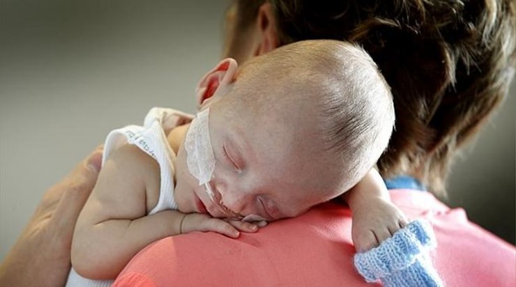 Ελληνόπουλο γεννήθηκε 395 γραμ. και επέζησε