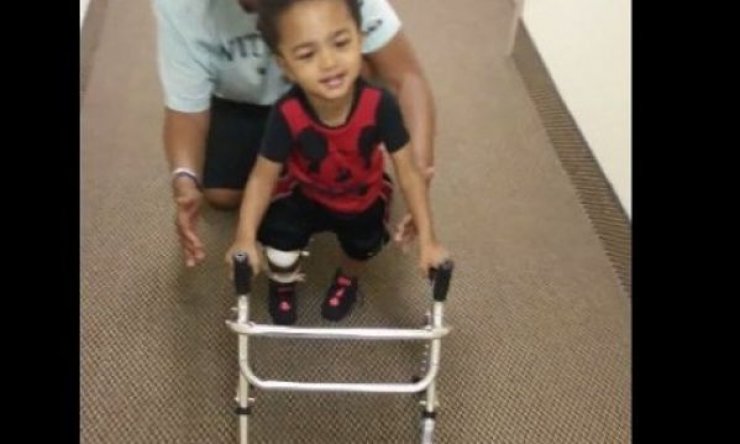 Δύναμη ψυχής! Το μικρό αγοράκι που κάνει τα πρώτα του βήματα με προσθετικό μέλος (βίντεο)  